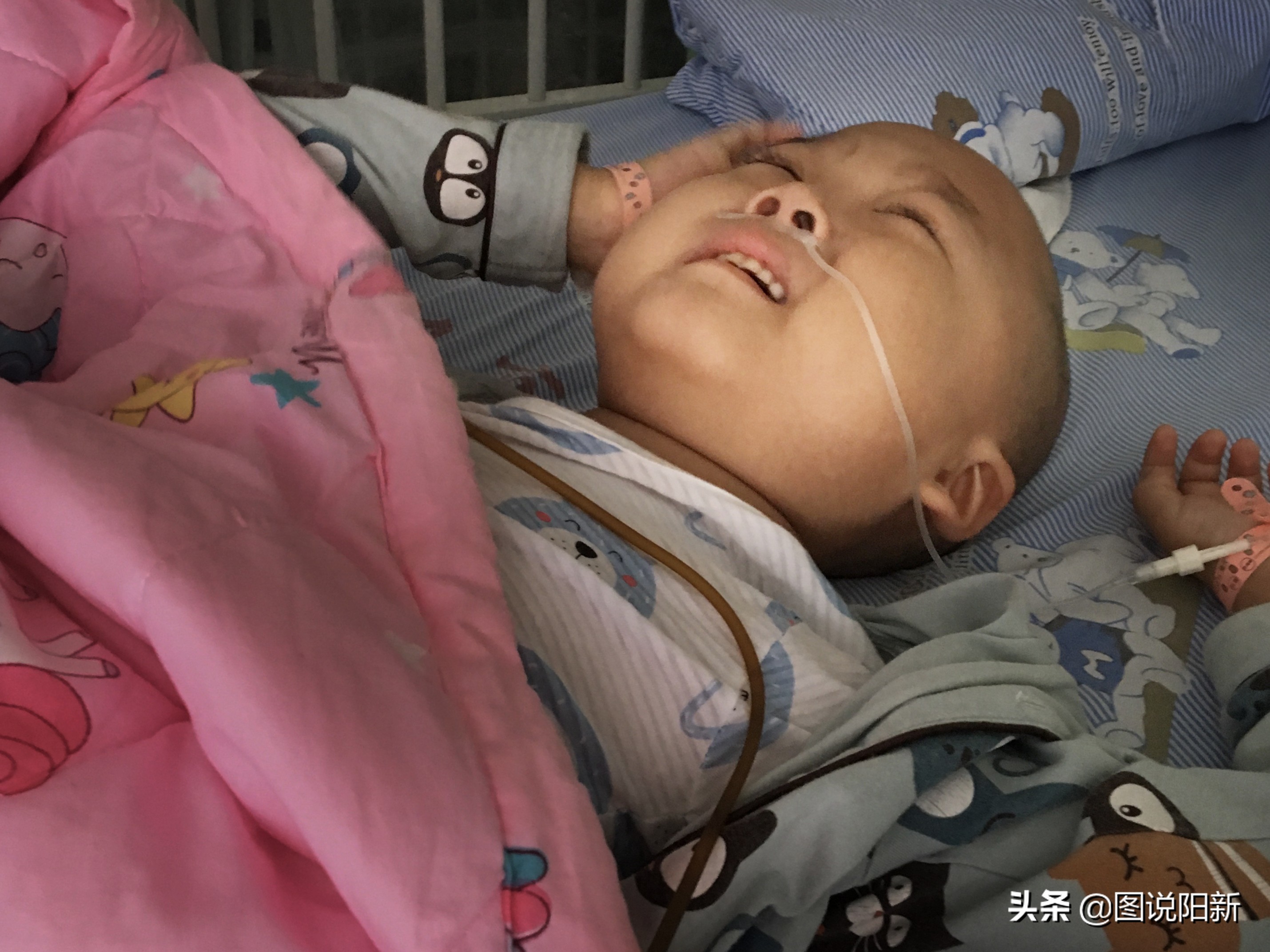 2岁男童确诊新冠,两名病情好转的心冠患者