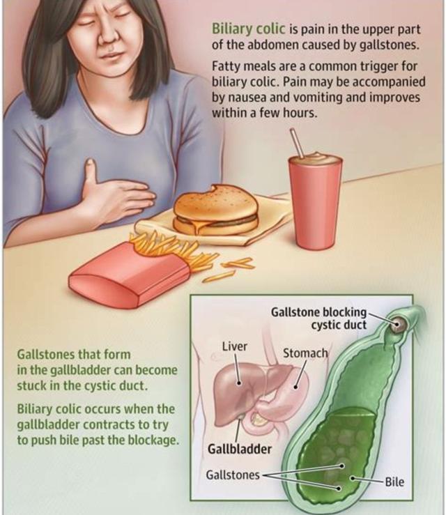 肩膀疼痛要警惕的三种病怎么治疗,肩膀疼痛要警惕的病怎么治疗