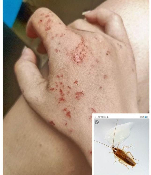 快递里发现蟑螂卵,女子网购衣服发现有蟑螂卵