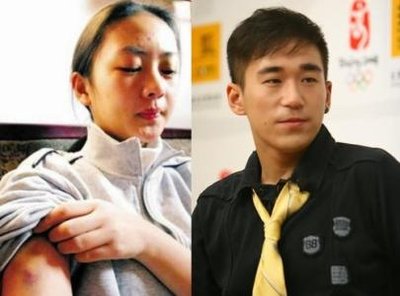 张默当年打童瑶的事,当年张默打童瑶的事