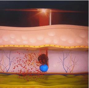 化妆都掩盖不住的黑眼圈,化妆也遮不住黑眼圈怎么办