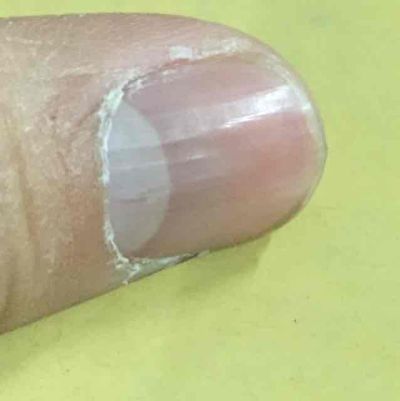 贫血怎么办最简单的方法,贫血怎么办