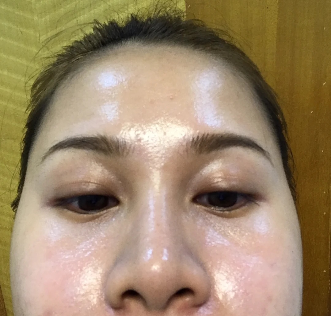 油性皮肤更抗衰老吗,油性皮肤保湿有用吗