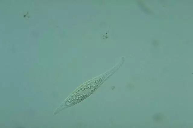 收藏!24种污水处理微生物菌相及指导意义,环保人必看(多图)