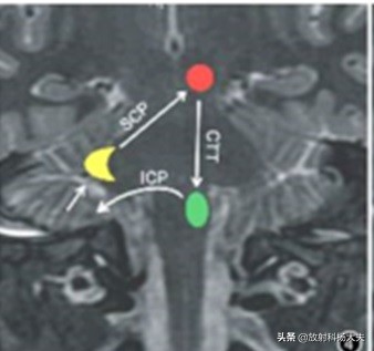 放射科趣味图片,放射科亮点图片