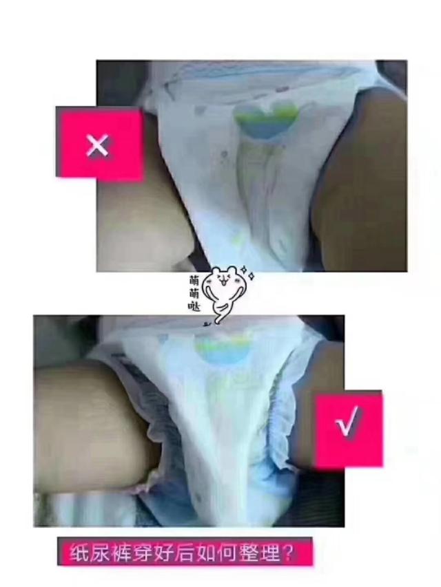 中年妈妈漏尿最好的治疗方法,漏尿的妈妈日常怎么护理