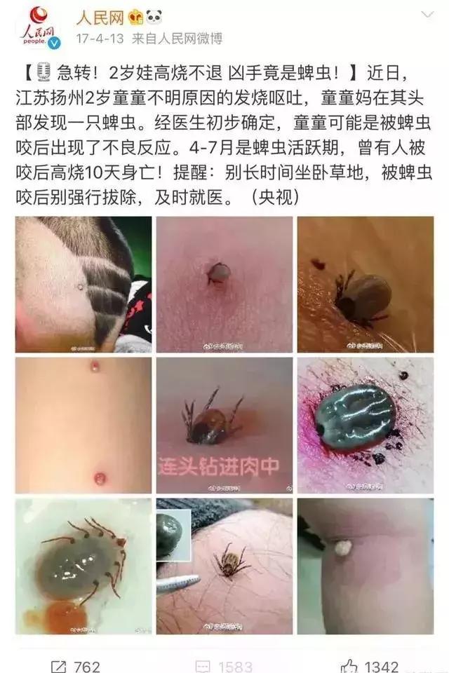 小朋友身上有多处黑痣怎么回事,十岁男孩身上长黑痣是什么原因
