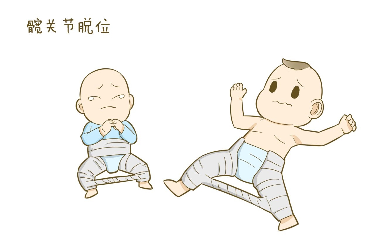 宝宝刚出生，婆婆就给宝宝绑手绑腿，害得被医生训斥