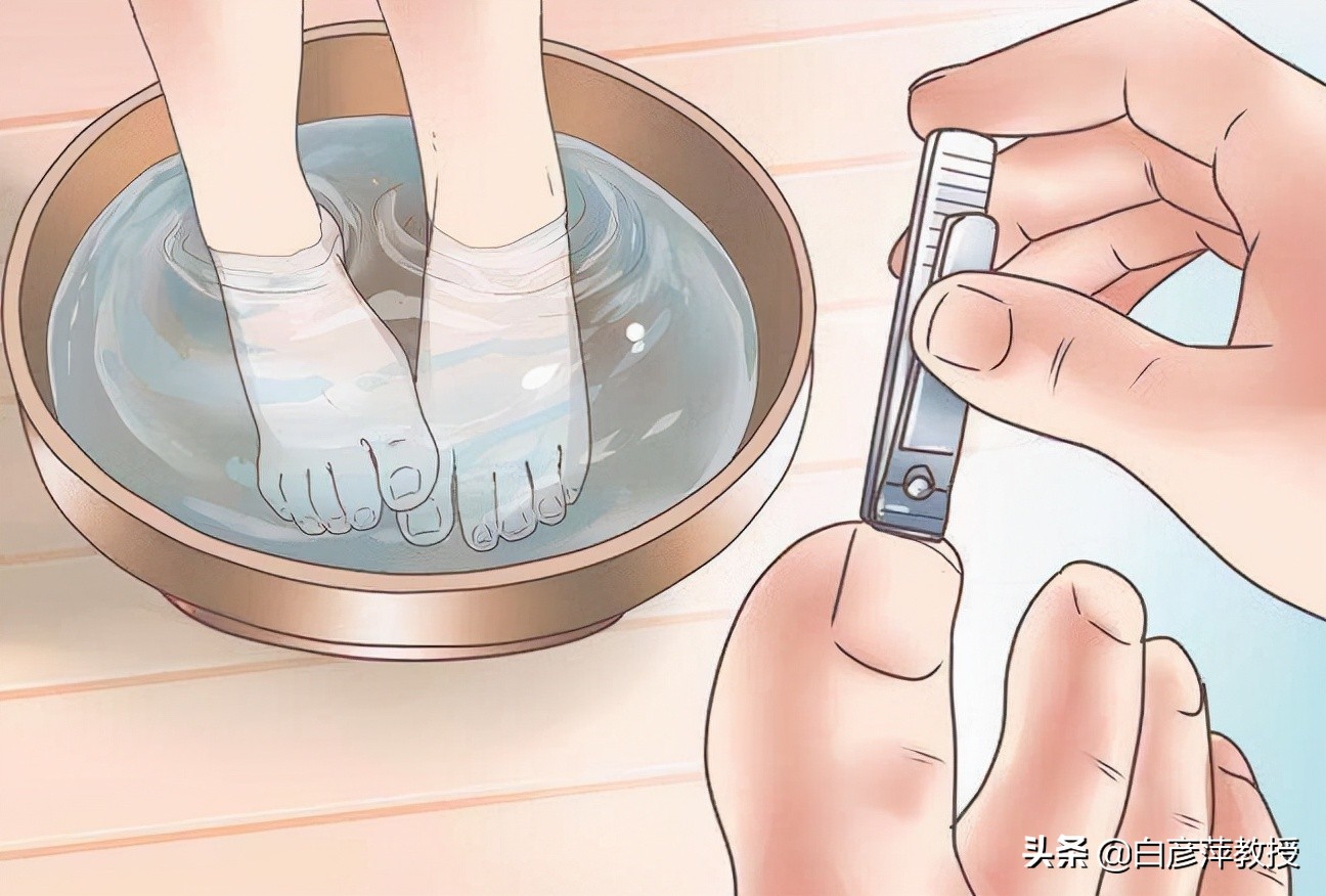 灰指甲是灰色的吗？灰指甲真的会传染吗？皮肤科医生告诉你