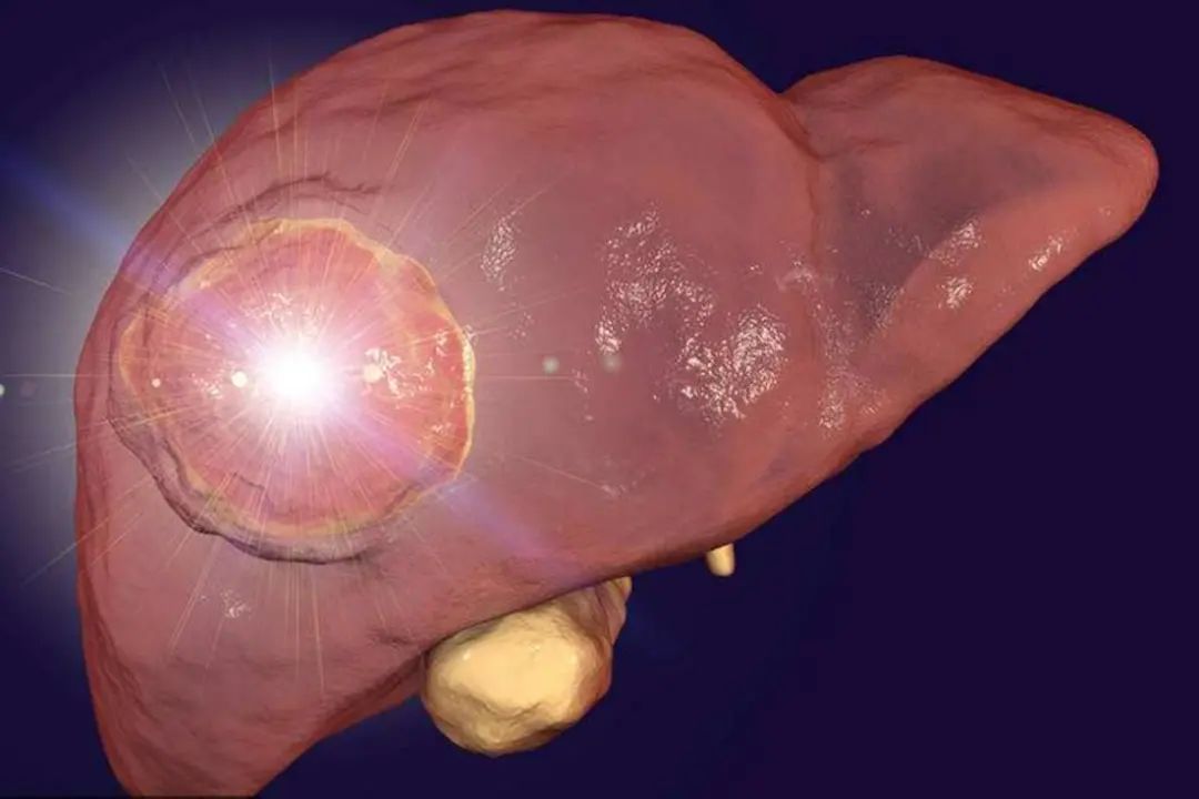 中医肝病专家陆禹舟,陆禹舟教授