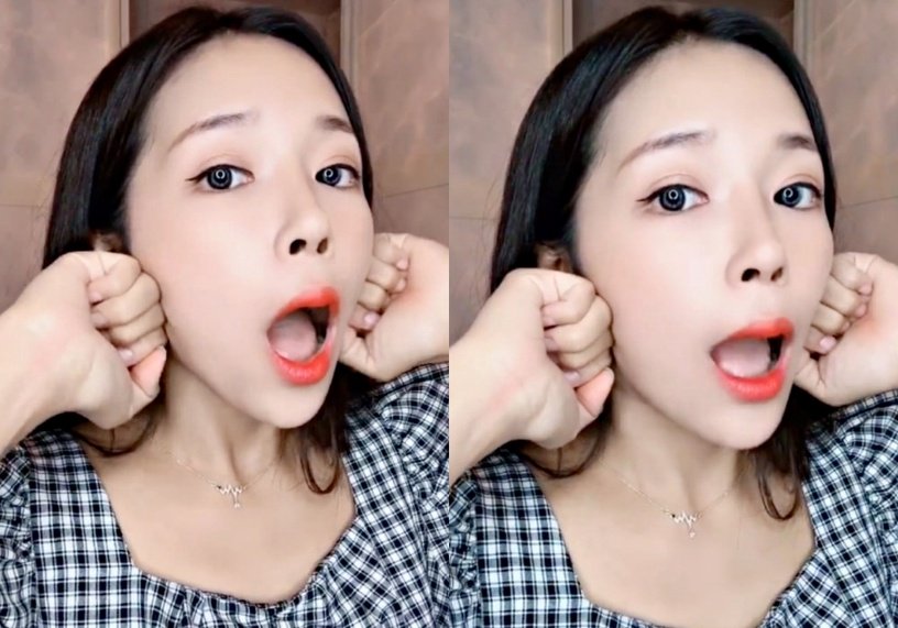 大小脸怎么矫正咀嚼肌,经常按摩面部咬肌可以瘦脸吗