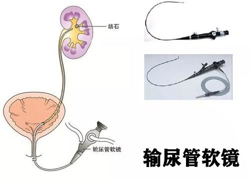泌尿外科是指哪方面,泌尿外科都是些什么病人