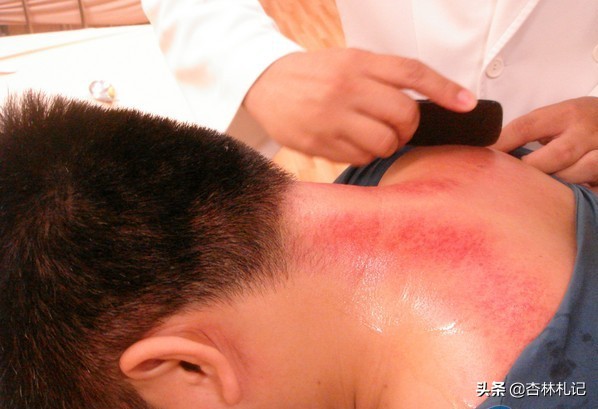 在家怎么刮痧才是正确的方法,刮痧教程