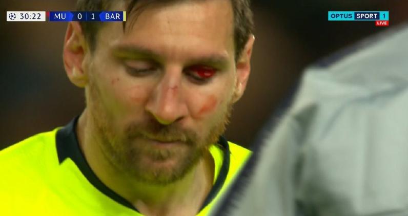 梅西踢出10分球,梅西踢出了诡异的弧线球