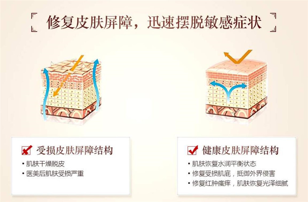 换季皮肤泛红发痒怎么快速解决,春季换季皮肤干燥过敏泛红刺痛