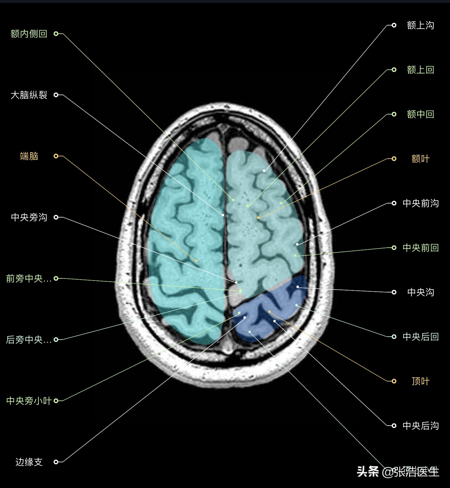 颅脑mri断层解剖视频课件,颅脑mri解剖手绘图