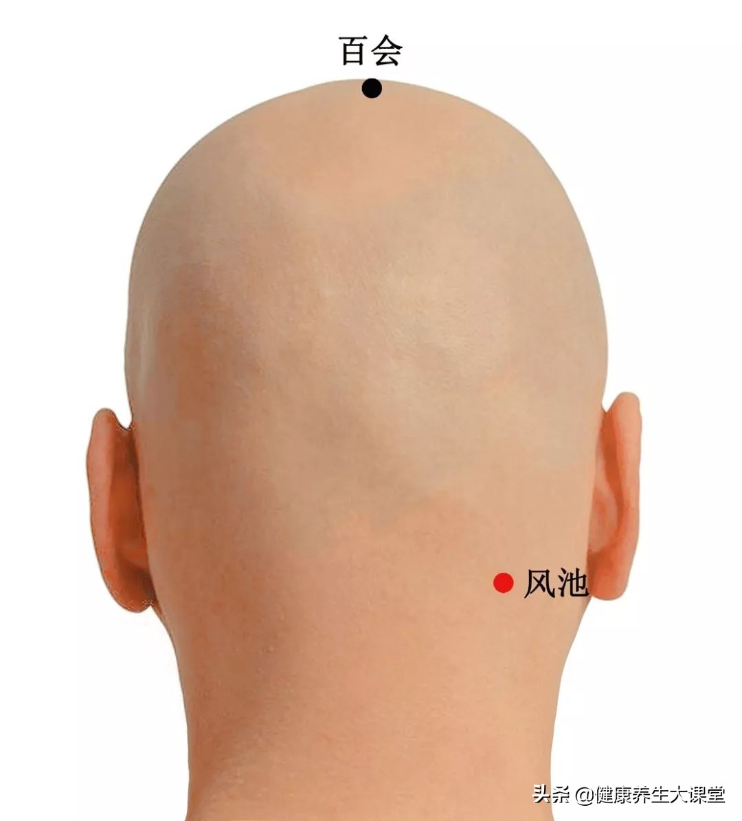 铲平富贵包,平整富贵包