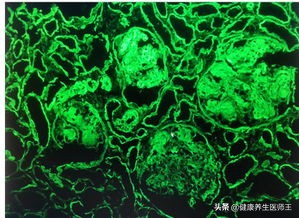肿瘤标志物筛查多少钱,肺肿瘤标志物有哪几项