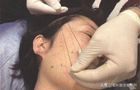 40岁-50岁上下，对抗面部松弛这些“弯路”请绕行？