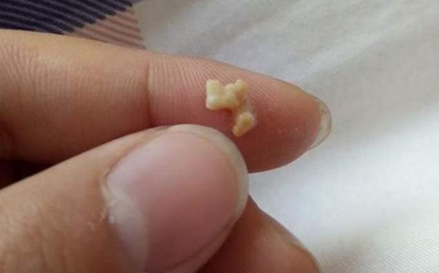 孩子被嫌弃太臭家长带去医院检查,儿子被同学嫌弃