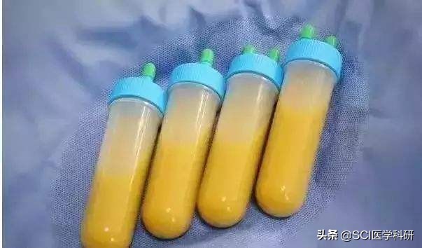 粪便移植能治什么病,粪便移植可以治疗便秘么