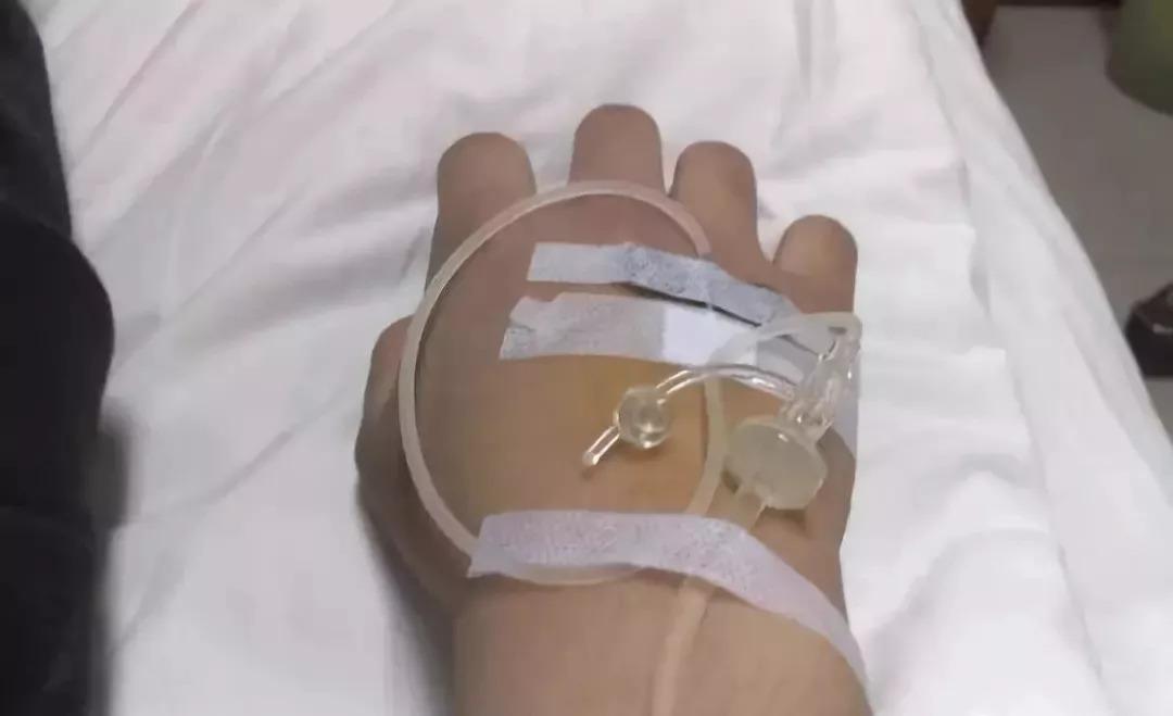 先天性酪氨酸病症状,遗传性酪氨酸血症