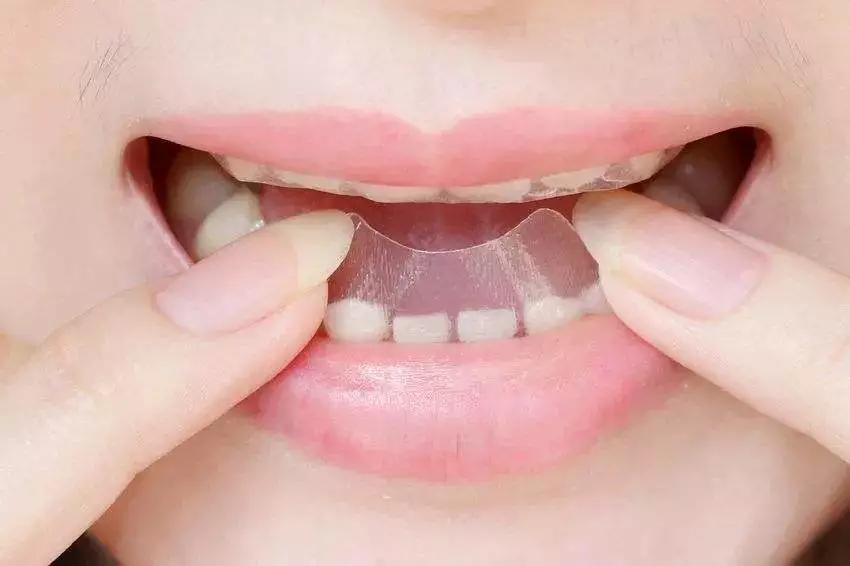 牙黄最有效变白方法,牙黄变白的正确方法学生党