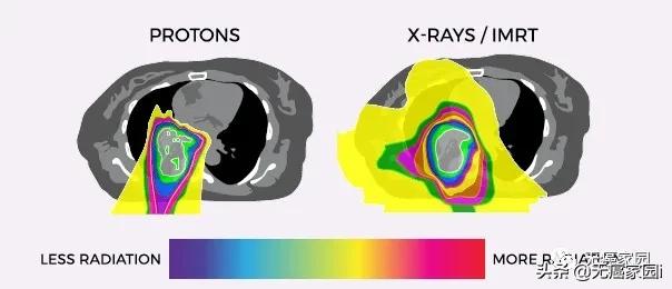 质子治疗手术适合大型肿瘤,肿瘤不能根治吗