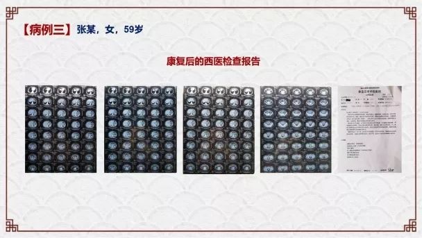 肿瘤与糖尿病的区别,糖尿病与癌症之间回顾性分析