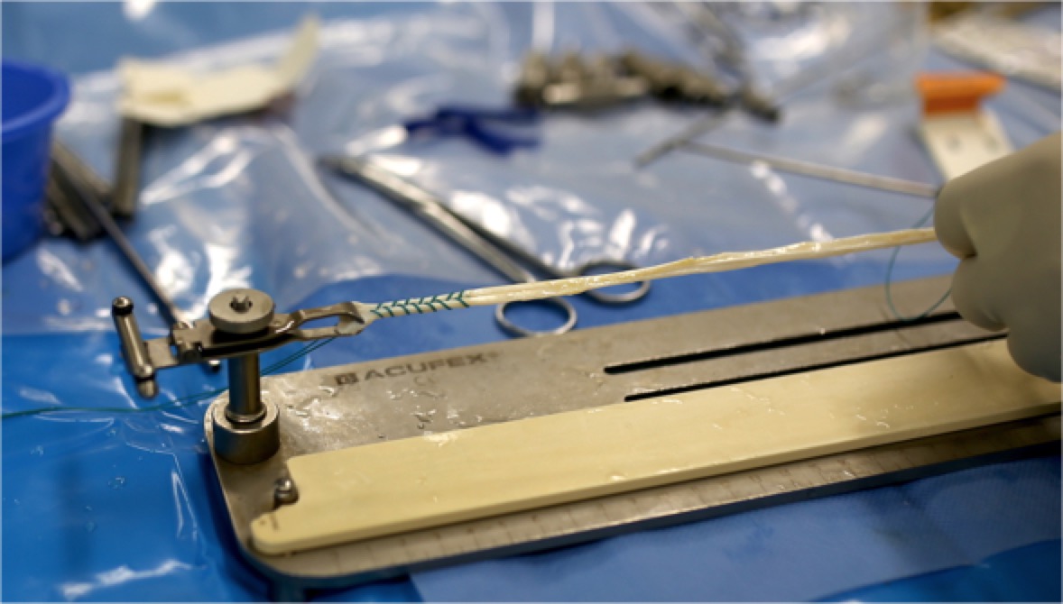 膝关节前叉韧带损伤最佳恢复方法,膝关节前韧带断了必须手术吗