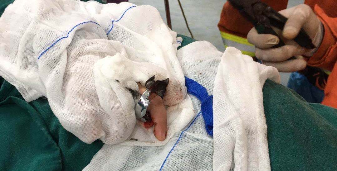 银戒指儿童,银戒指治宝宝惊吓