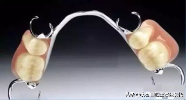 拔了一侧的两颗牙齿如何镶牙,镶一颗牙两侧牙齿不好怎么办