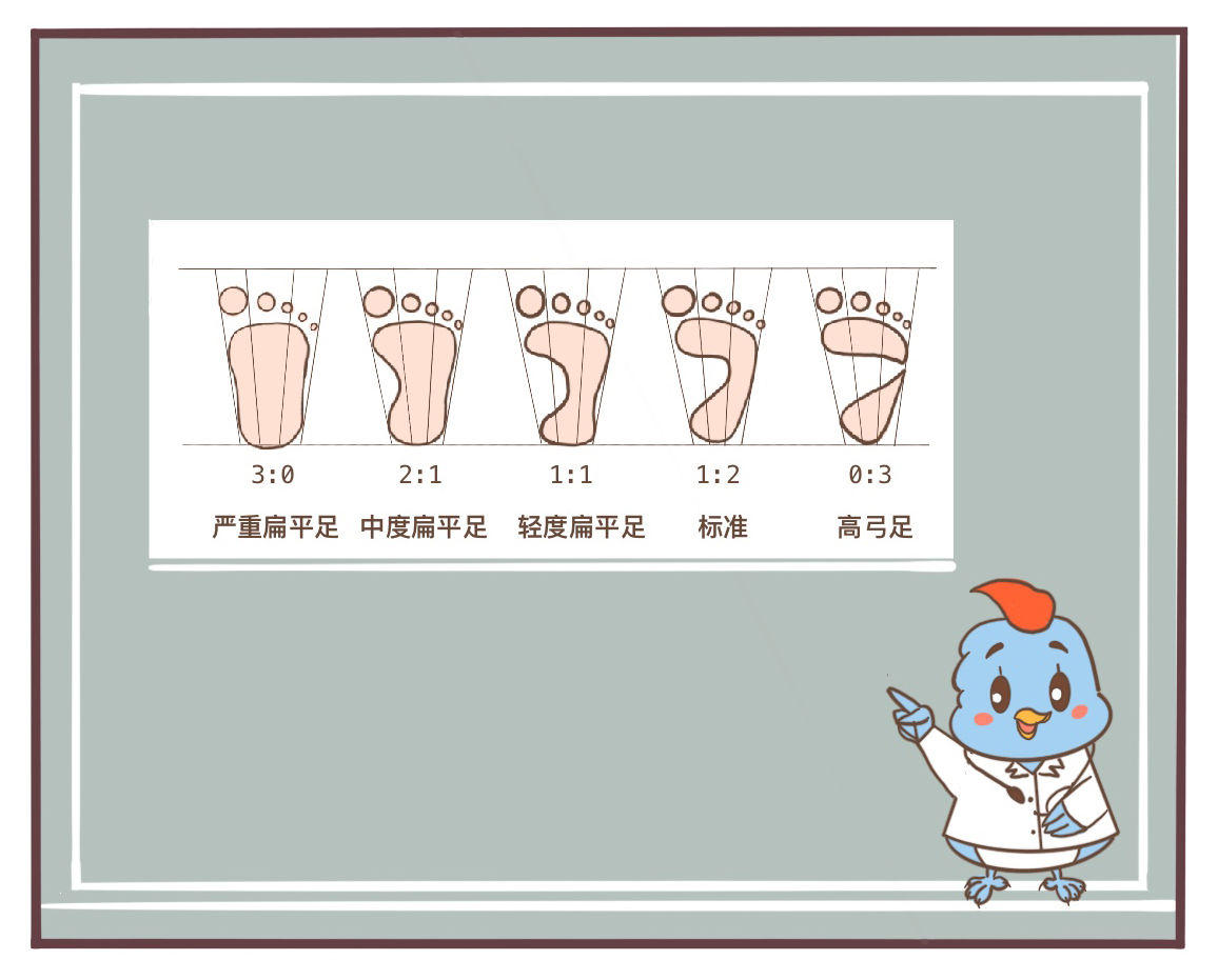 扁平足的矫正方法动画片,扁平足的危害漫画