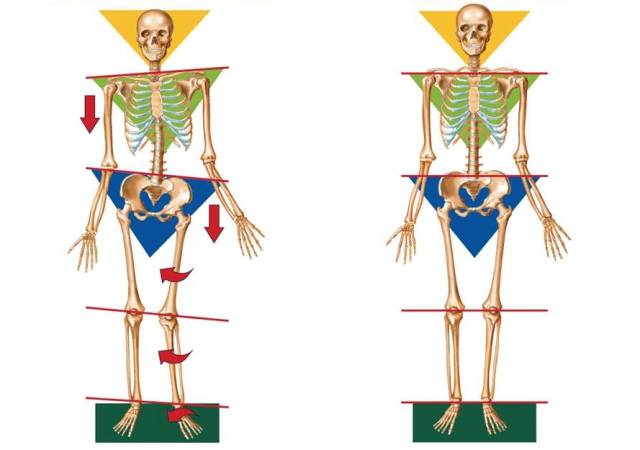 幼猫走路外八字怎么纠正,纠正内八字的训练方法