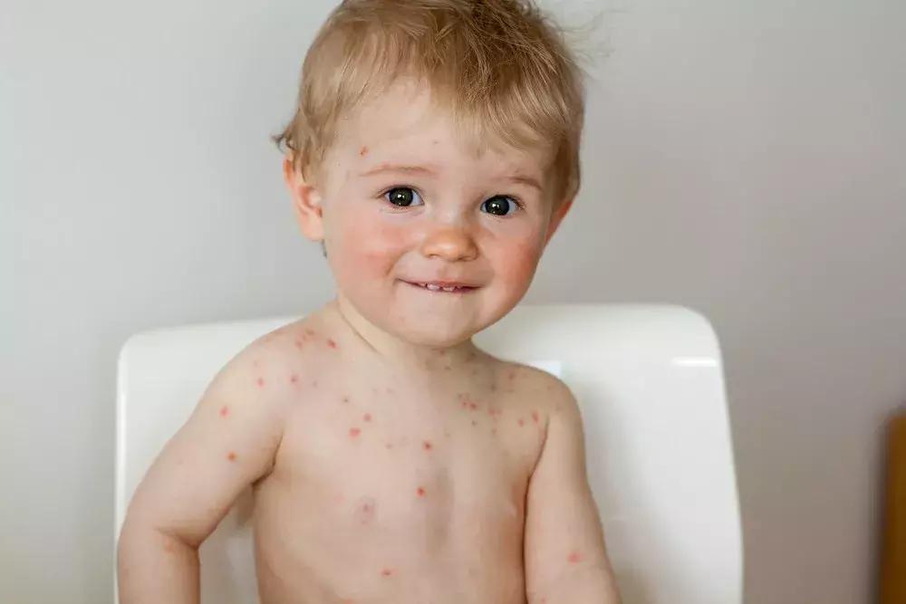 不超过十块钱的实用好药,实用不贵的皮肤药膏