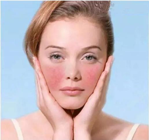 铁过敏引起的皮肤瘙痒用什么药,皮肤瘙痒过敏警惕4种疾病