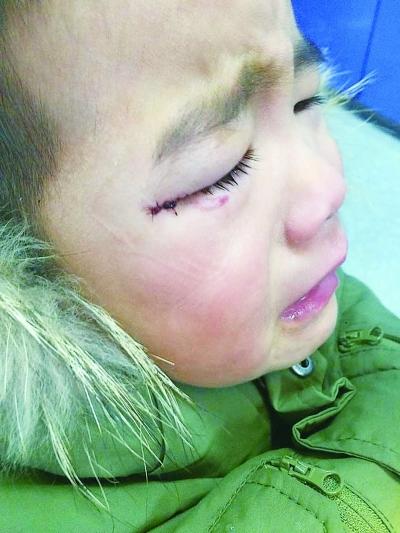 儿子误把502滴眼睛,宝妈反应迅速医生夸奖,但家长不能跟一辈子
