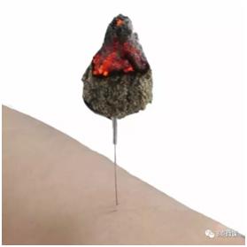 妇科炎症有积液用吃药不,盆腔积液盆腔炎最简单的自愈方法