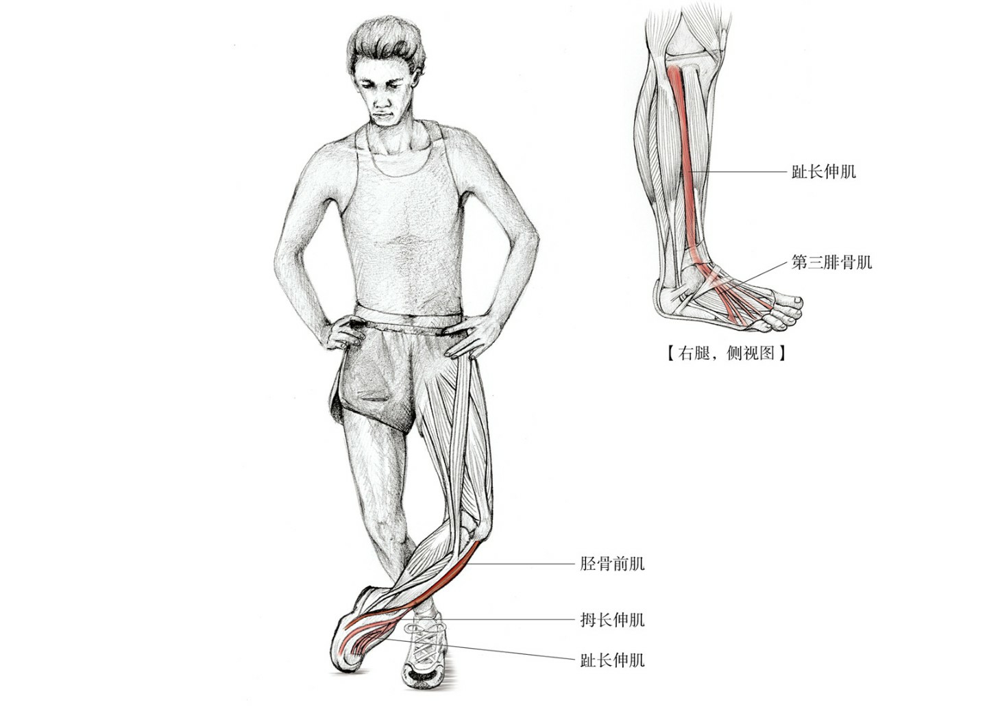 怎么判断脚踝崴脚还是扭伤,崴脚之后怎么恢复脚踝力量