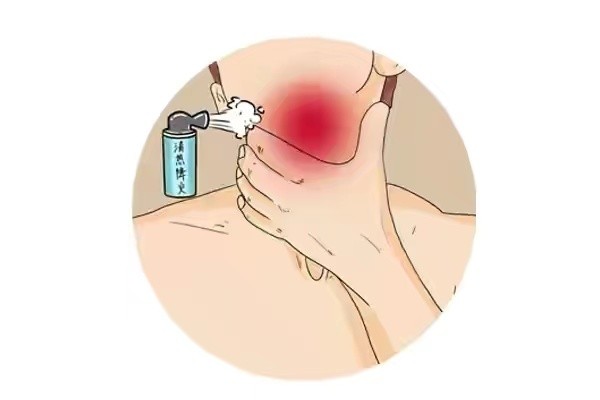 吐白痰和黑痰有什么区别,咳出黄痰黑痰白痰分别说明了啥