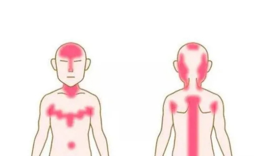 皮脂腺怎么处理,皮脂腺大怎么办