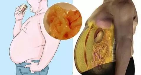 怎样减内脏脂肪最快最有效教程,减内脏脂肪最快的2个方法