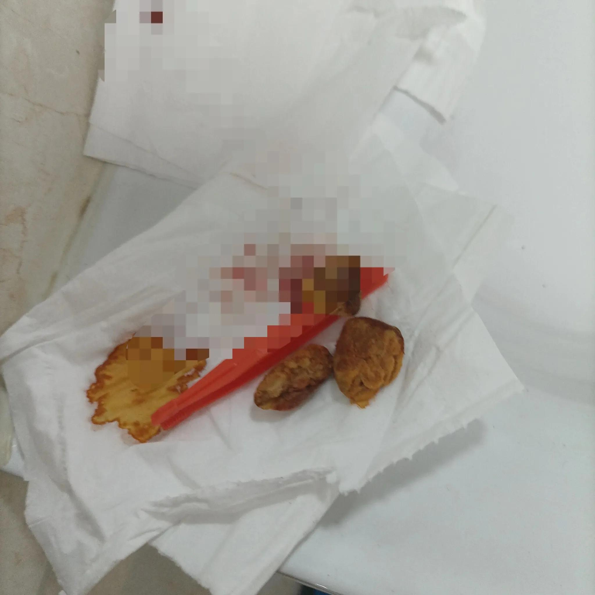 半夜摔倒头磕破了,晕倒导致头磕破出血了咋办