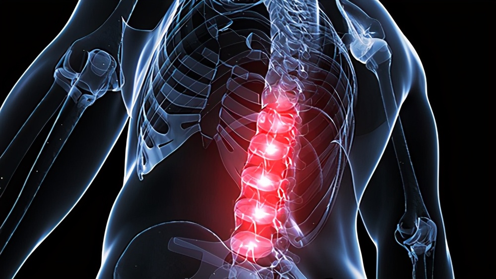 脊柱裂诊断与治疗,脊柱裂症状有哪些表现