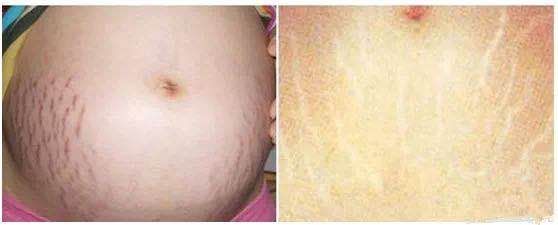 39岁高圆圆产后首次晒照,40岁高圆圆产后首次亮相