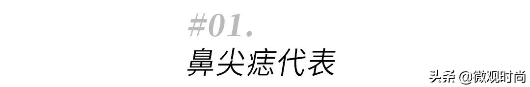 脸上有很多痣但是很好看的女生,脸上哪里有痣显好看