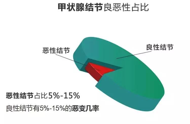 甲状腺结节从生长到发现要多久,甲状腺小结节要治疗吗