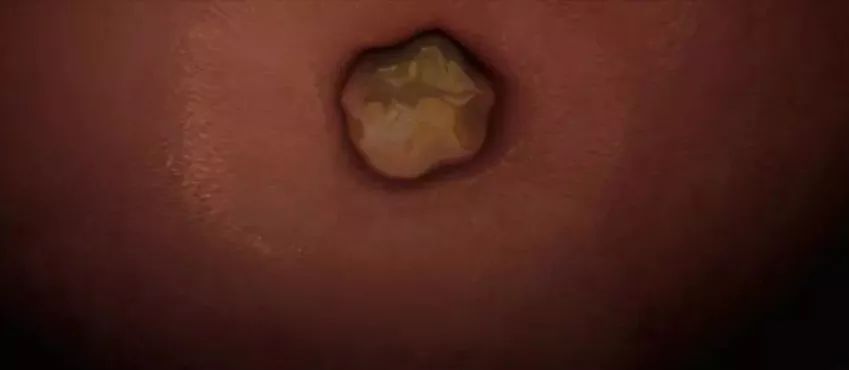 生命起源卵子,生命起源胚胎形成完整版