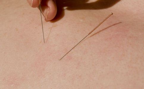 针灸对于腰椎疾病有什么作用,针灸治疗的五种常见病