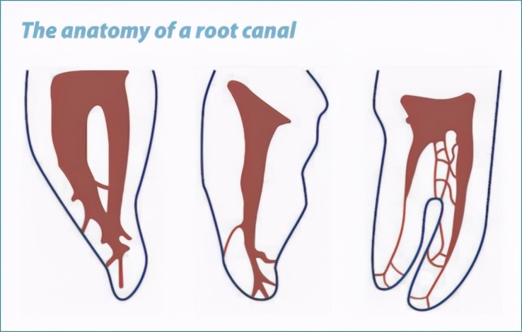 根管锉加工设备,益锐M3根管锉